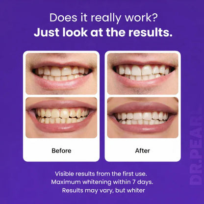 Ultra-thin Purple Whitening Strips